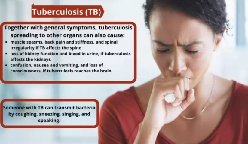 Tuberculosis Symptoms Causes and Treatment
