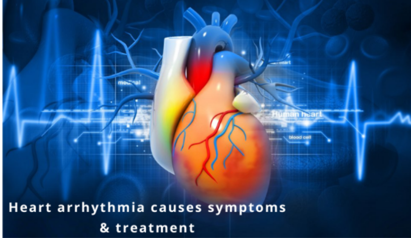Heart arrhythmia causes symptoms & treatment