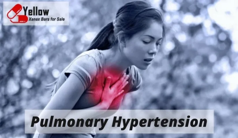 Pulmonary Hypertension?
